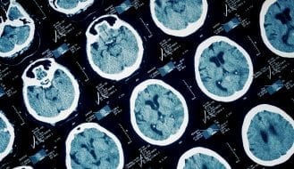 Brain scans